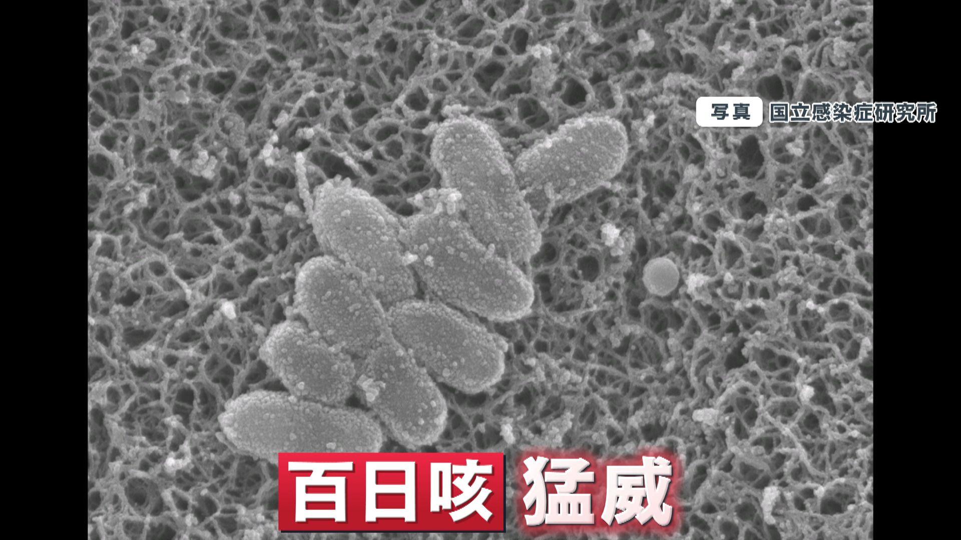 「長引くせきを放置しない」中国で百日咳が猛威をふるう 感染力ははしかに近く、死亡につながることも…
